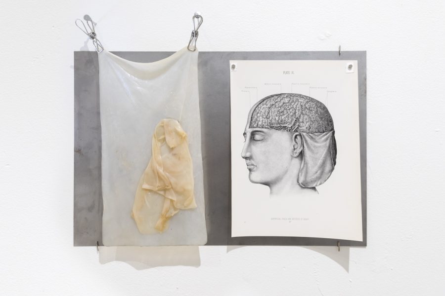 An anatomical illustration of the human brain is pinned next to a sheet of wet bacterial cellulose on a sheet of wall mounted metal.