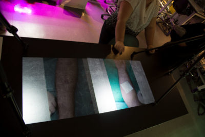 Interactive projection of two arms undergoing medical procedure onto the surface of a black table