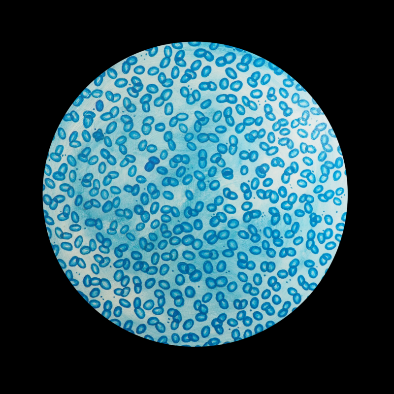 This painting is a bright baby blue, and resembles bacteria-like structures. It can be described as bacteria multiplying over and over again, until it fills up the canvas.