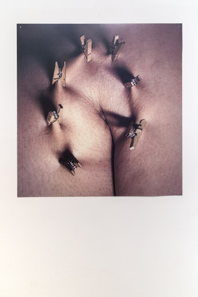 Photograph of a body fragment (probably an armpit) pierced with clothespins