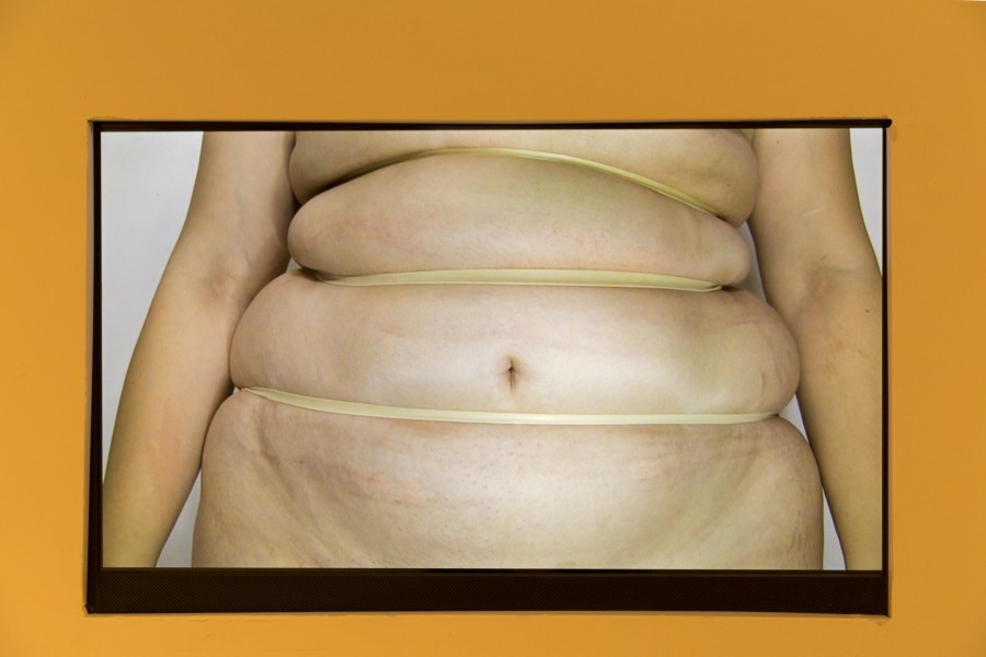Video of a body stomach wrapped with 3 elastic bands.