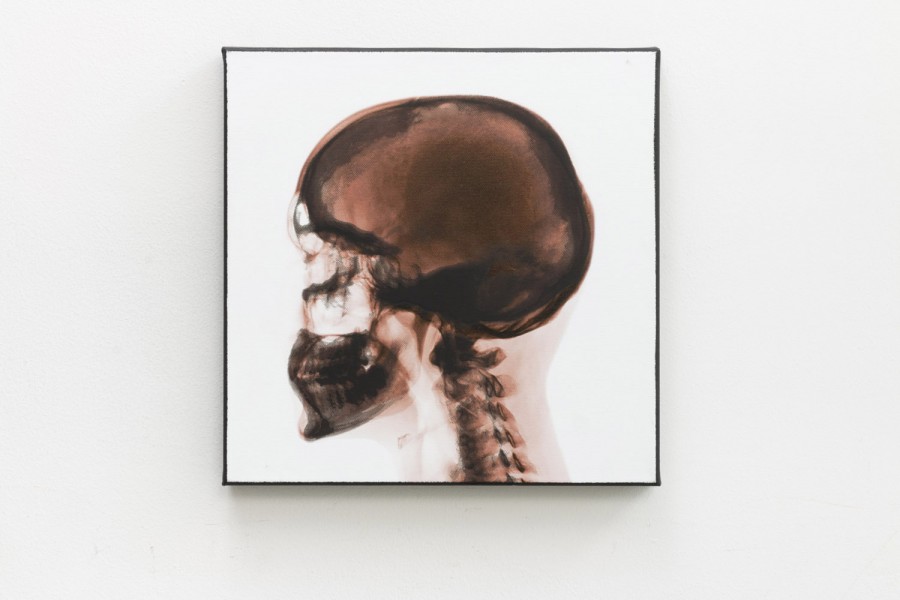 Side view of skull radiography on a white background and a black square frame.